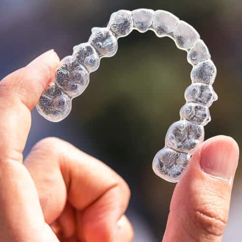 Invisalign in Alexandria, VA