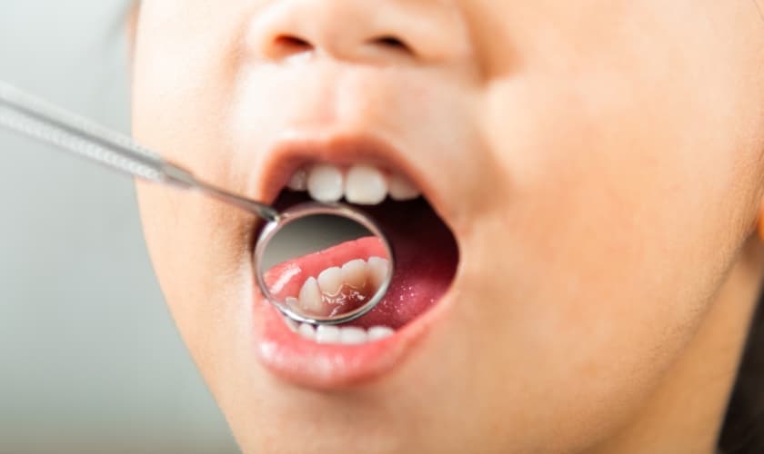 Maintaining good oral health in Alexandria, VA | Alexandria Dental Spa