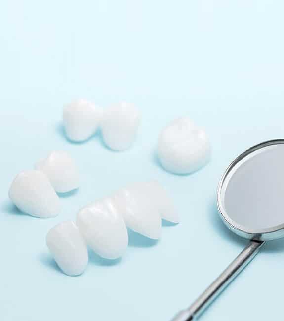 Porcelain Dental Veneers in Alexandria, VA | Alexandria Dental Spa