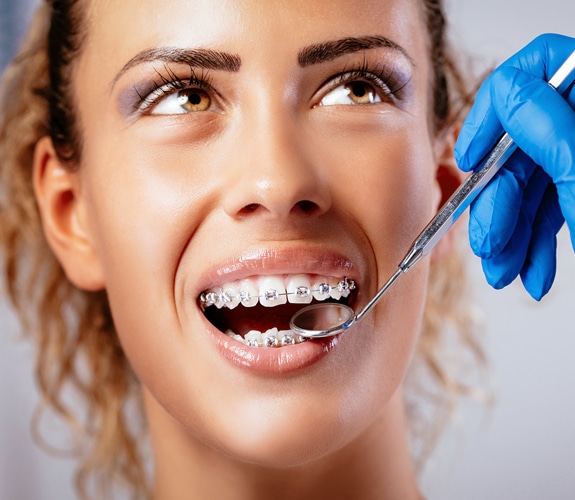 Retainers And Post-Orthodontic in Alexandria, VA | Alexandria Dental Spa