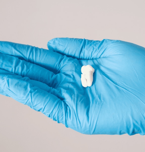 Wisdom Teeth Removal in Alexandria, VA | Alexandria Dental Spa