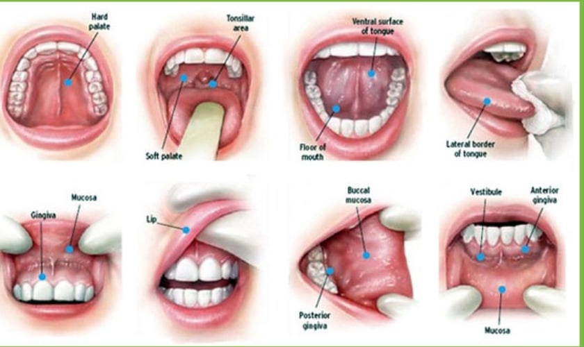 What a Dentist Alexandria Looks for During an Oral Cancer Screening