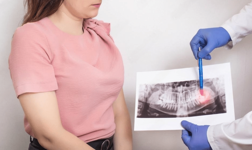 early wisdom teeth removal