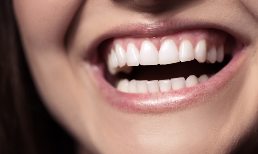 Smile Makeover Secrets Celebrities Don’t Want You to Know