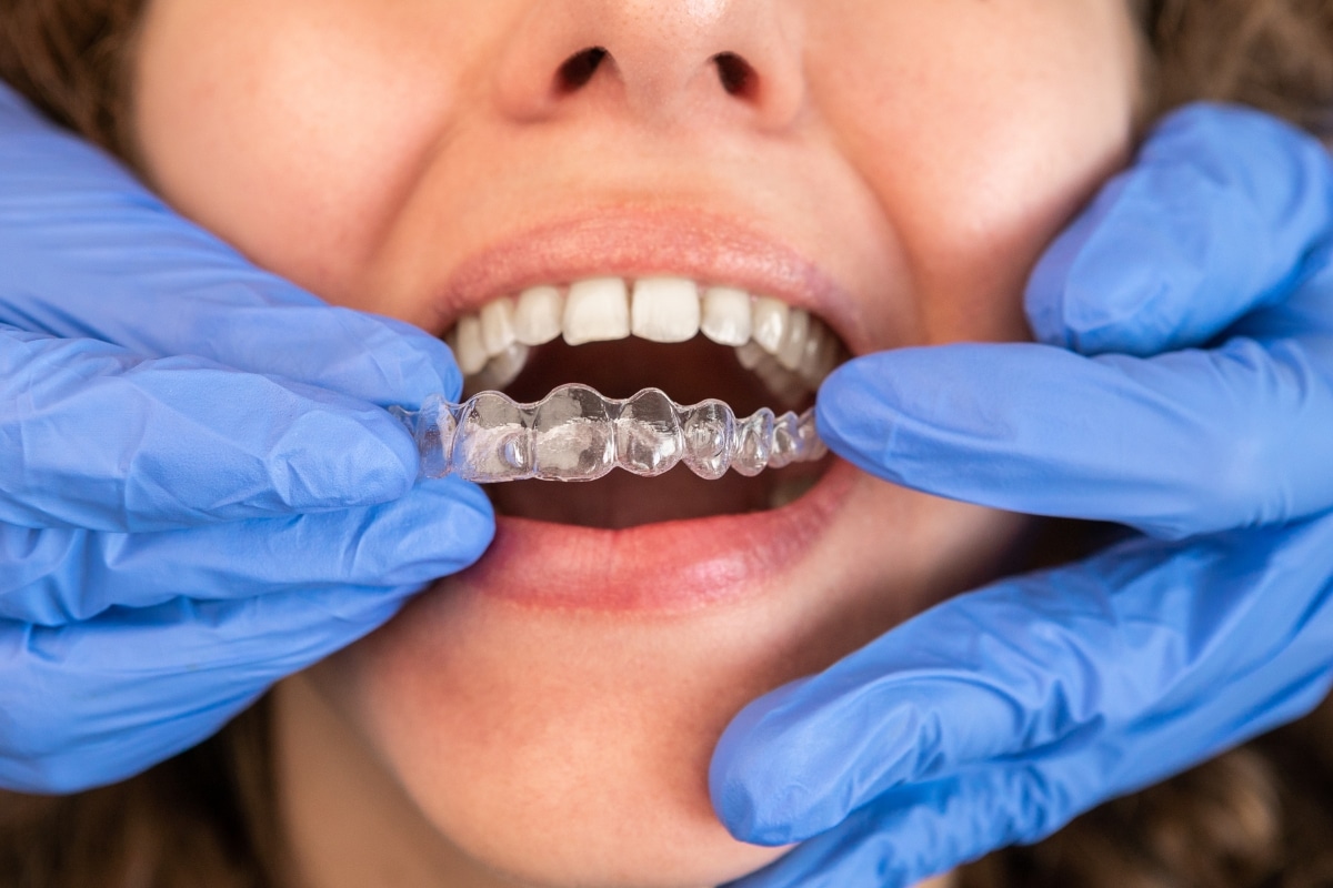 orthodontic-care-in-Alexandria-VA