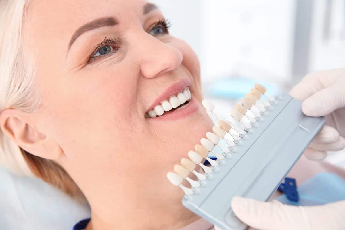 Veneers in Lake Barcroft