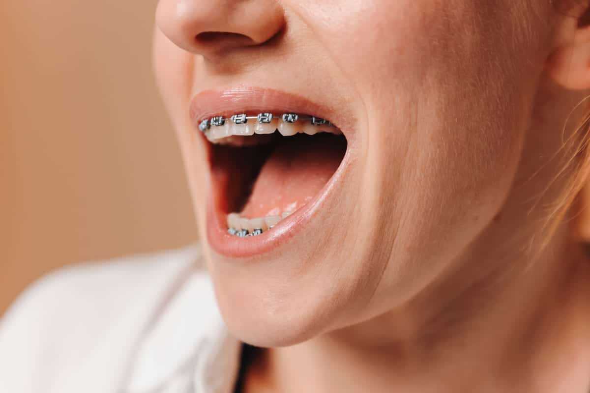 Orthodontics in Alexandria
